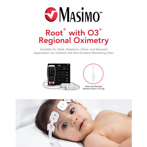 Masimo Patient Monitoring